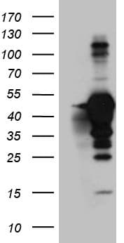 Monoclonal Mouse anti-Human MAGEB4 Antibody (clone OTI2H5, aa1-193, WB)