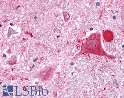 PathPlus™ GPR63 Antibody (C-Terminus)