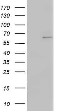KRT7 / CK7 / Cytokeratin 7 Antibody (clone OTI2E11)