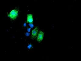 RPN1 / Ribophorin I Antibody (clone OTI2G1)