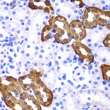 IHC-plus™ KRT19 / CK19 / Cytokeratin 19 Antibody