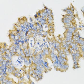 GHRL / Ghrelin Preproprotein Antibody