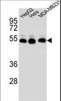 TUBB2B / Tubulin Beta 2B Antibody (aa12-39)