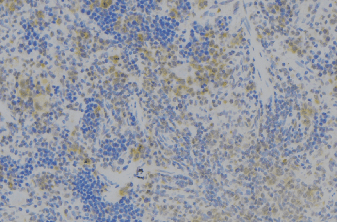TNFSF4 / OX40L / CD252 Antibody