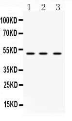 Polyclonal Rabbit anti-Human TNFRSF10A / DR4 Antibody (IHC, WB)