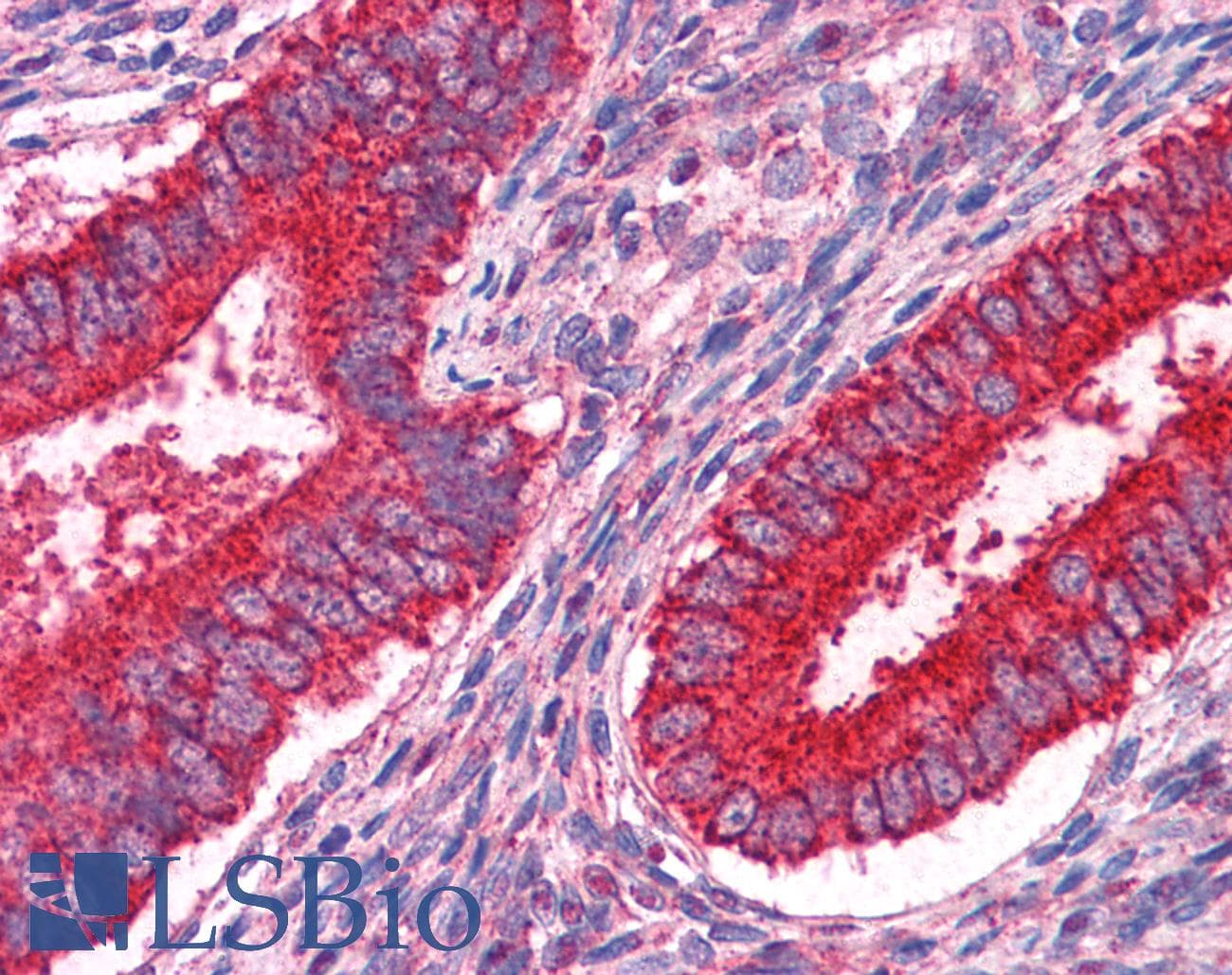 IHC-plus™ Monoclonal Mouse anti-Human JUP/CTNNG/Junction Plakoglobin Antibody (clone 2G9, IHC, IF, WB)