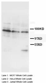 Polyclonal Rabbit anti-Human INSR / Insulin Receptor Antibody (Sepharose, N-Terminus)
