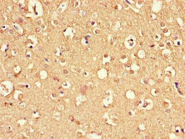 DNAJC6 Antibody