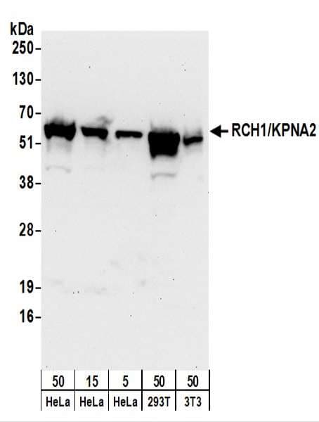 IHC-plus™ KPNA2 / Importin Alpha 1 Antibody (aa475-C-term)