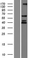 CRD-BP / ZBP1 / IGF2BP1 Protein (Over-Expression Lysate Myc-DDK (Flag))