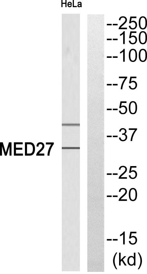 Polyclonal Rabbit anti-Human MED27 / CRSP8 Antibody (WB)