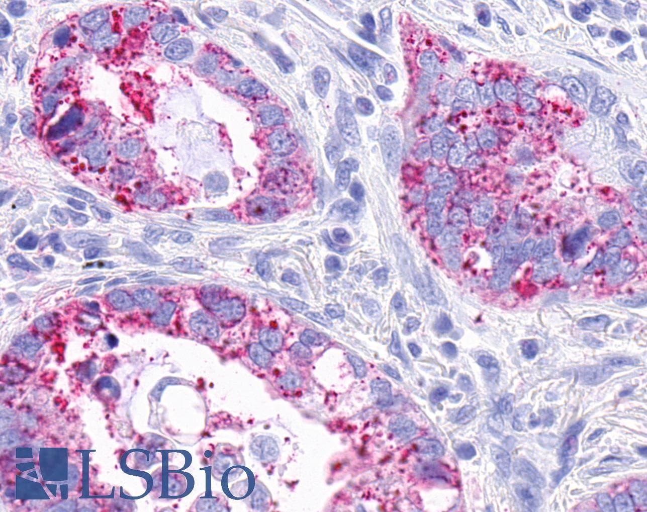 PathPlus™ Polyclonal Rabbit anti-Human MRGPRX3 / MRGX3 Antibody (Extracellular Domain, IHC)