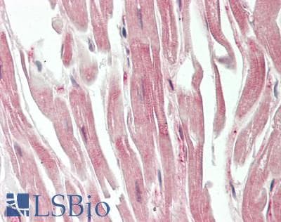IHC-plus™ Polyclonal Rabbit anti-Human LRIG2 Antibody (aa817-845, IHC, WB)