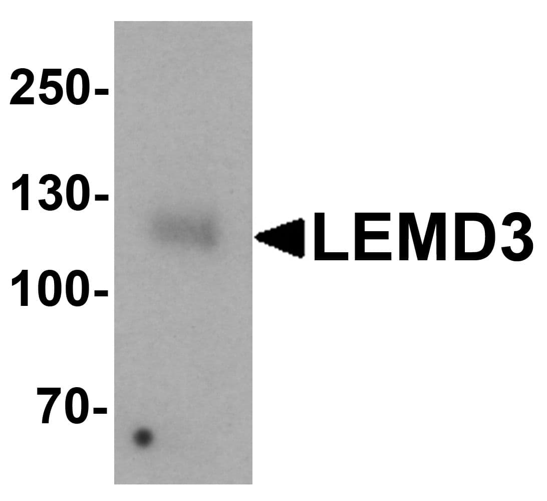 IHC-plus™ Polyclonal Rabbit anti-Human LEMD3 / MAN1 Antibody (IHC, IF, WB)