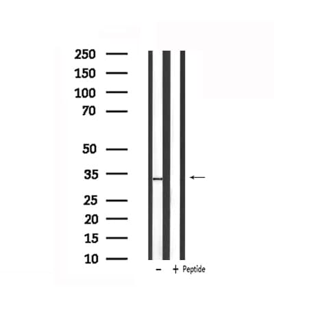 Polyclonal Rabbit anti-Human STAR Antibody (IHC, WB)