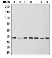 Polyclonal Rabbit anti-Human IKBKG / NEMO / IKK Gamma Antibody (Internal, IHC, IF, WB)