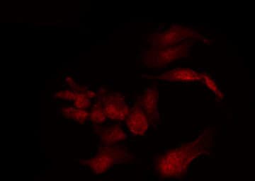 PPP1R1B / DARPP-32 Antibody
