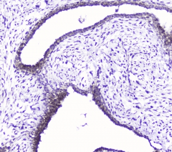 Polyclonal Rabbit anti-Human CDK6 Antibody (IHC, WB)