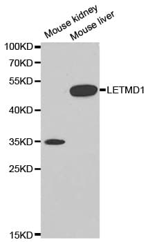 LETMD1 / HCCR1 Antibody