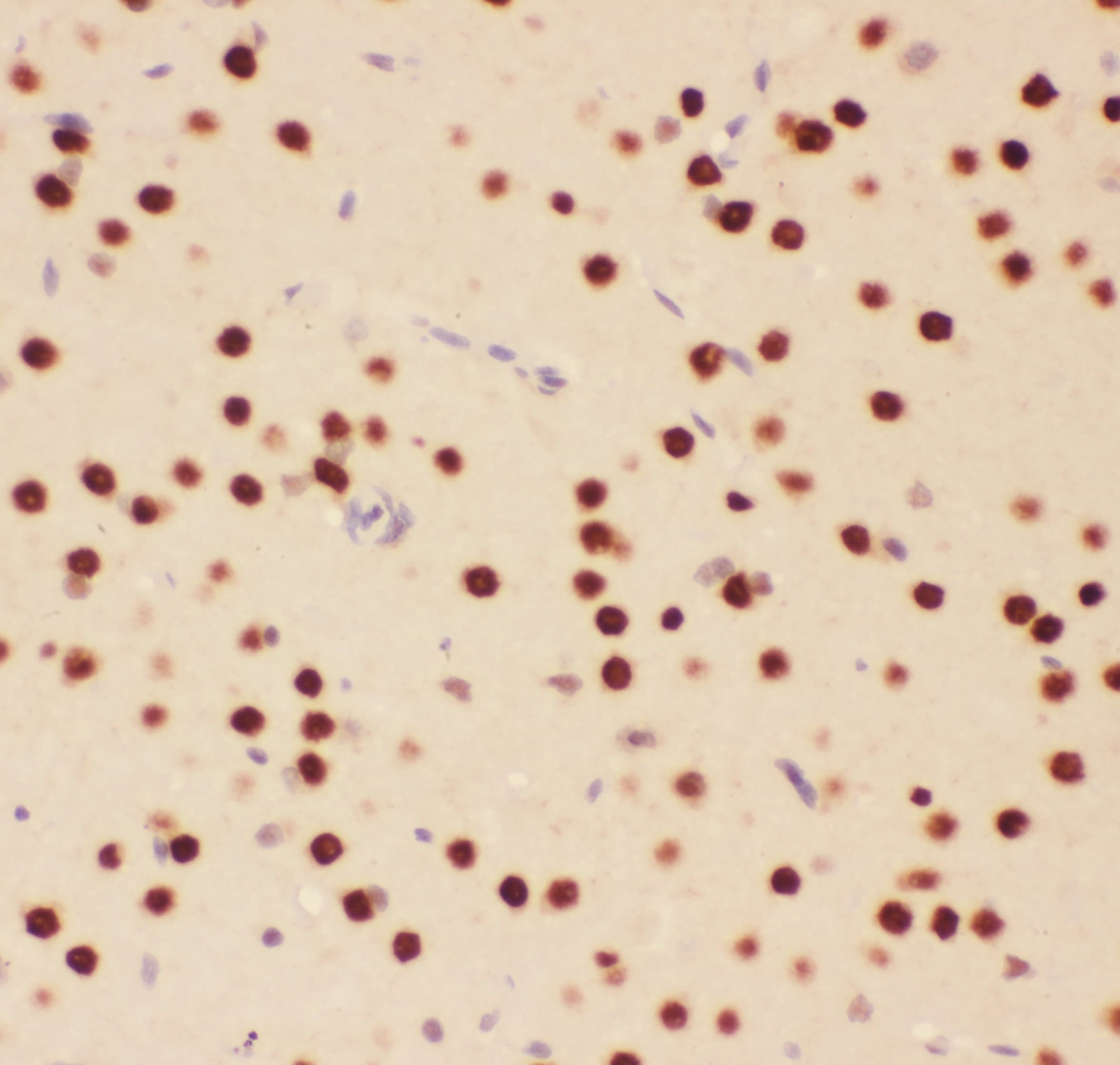 ATF2 Antibody (aa93-450)