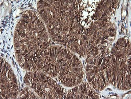FAK / Focal Adhesion Kinase Antibody (clone OTI4A8)