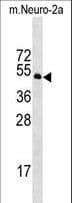 Polyclonal Rabbit anti-Mouse STK39 / SPAK Antibody (aa433-460, WB)