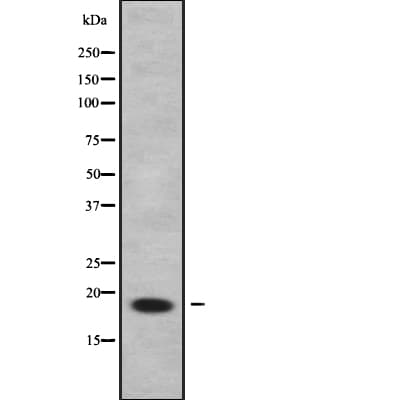 RPP25L / C9orf23 Antibody