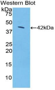 SDC1 / Syndecan 1 / CD138 Antibody (aa58-313)