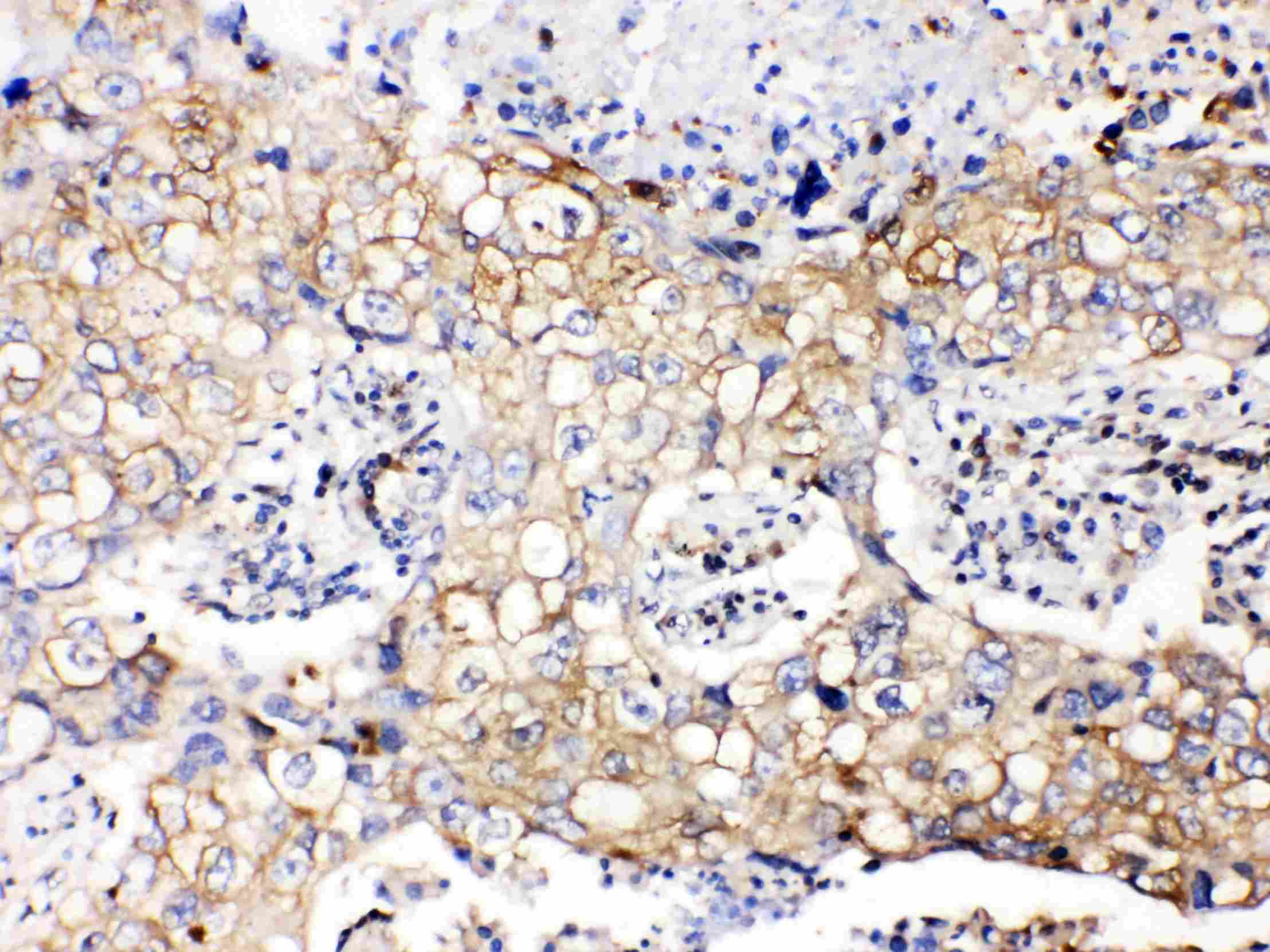 GAPDH Antibody
