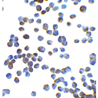 ZEB1 / AREB6 Antibody