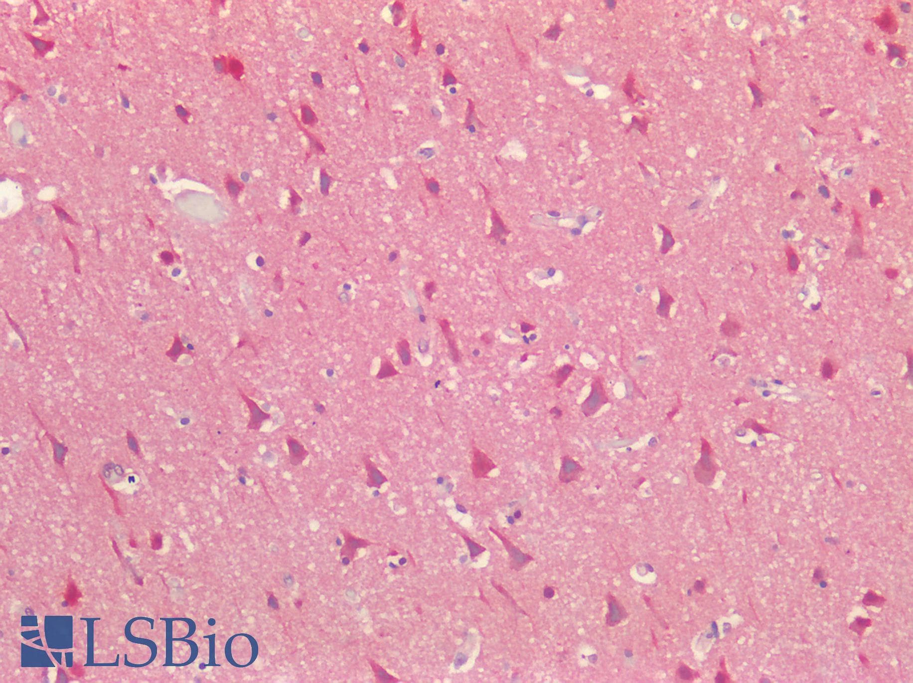 OTUB1 / OTU1 Antibody (clone AT17E10)
