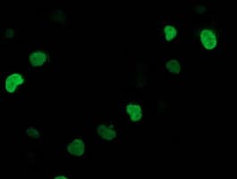 Monoclonal Mouse anti-Human SSX1 Antibody (clone OTI2F8, IHC, IF, WB)
