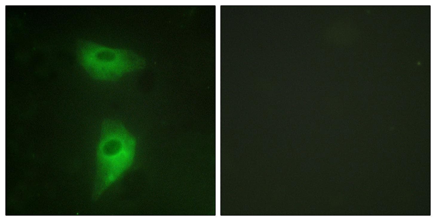 IGF2R / CD222 Antibody (Ab-2409)