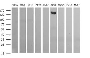IHC-plus™ CD163 Antibody (clone 2B12)