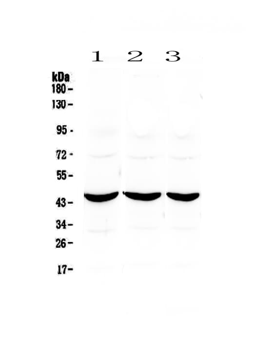 ADA / Adenosine Deaminase Antibody