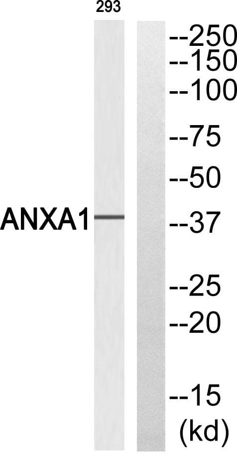 ANXA1 / Annexin A1 Antibody (p21)
