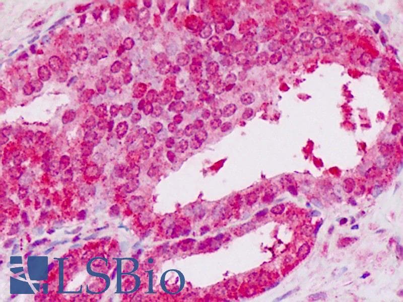 IHC-plus™ STAT2 Antibody (Tyr690, clone 19G8.H2.H6)