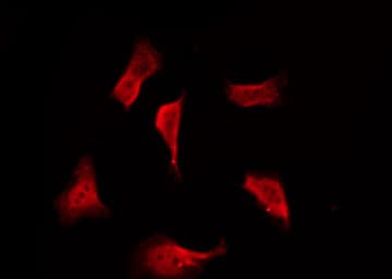 Polyclonal Rabbit anti-Human ADGRG5 /GPR114 Antibody (IF, WB)