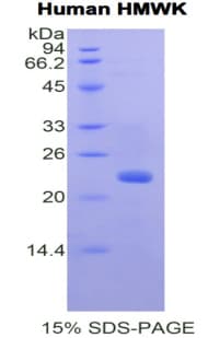 Human High Molecular Weight Kininogen Protein (Recombinant His)