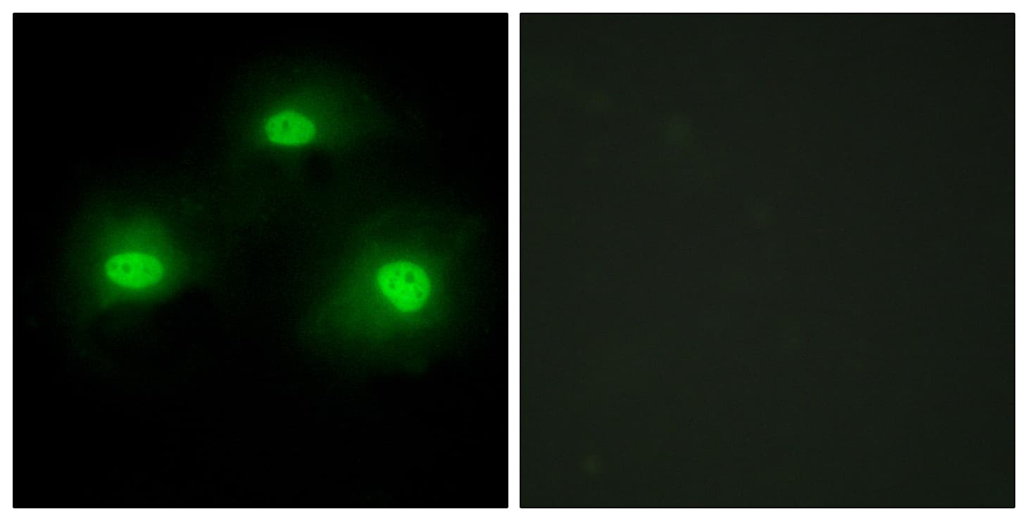 PKIA Antibody (aa10-59)