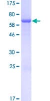 Human DUSP9 Protein (Recombinant GST)