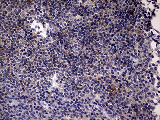 CD30 Antibody (aa19-379, clone OTI3A2)