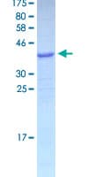Human GNLY / Granulysin Protein (Recombinant GST)