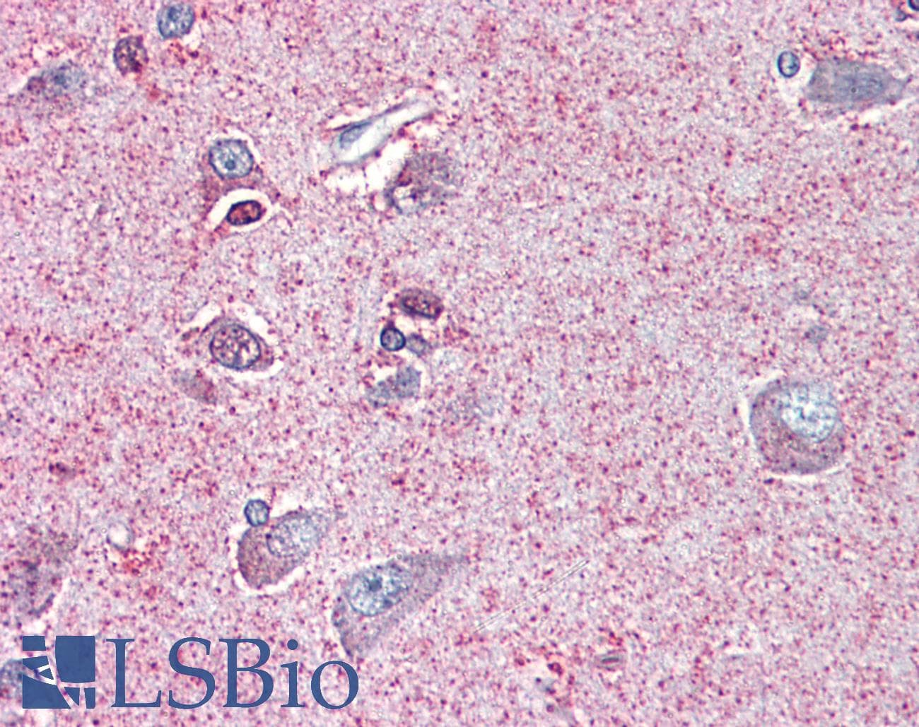 IHC-plus™ NTSR2 / NTR2 Antibody (Internal)