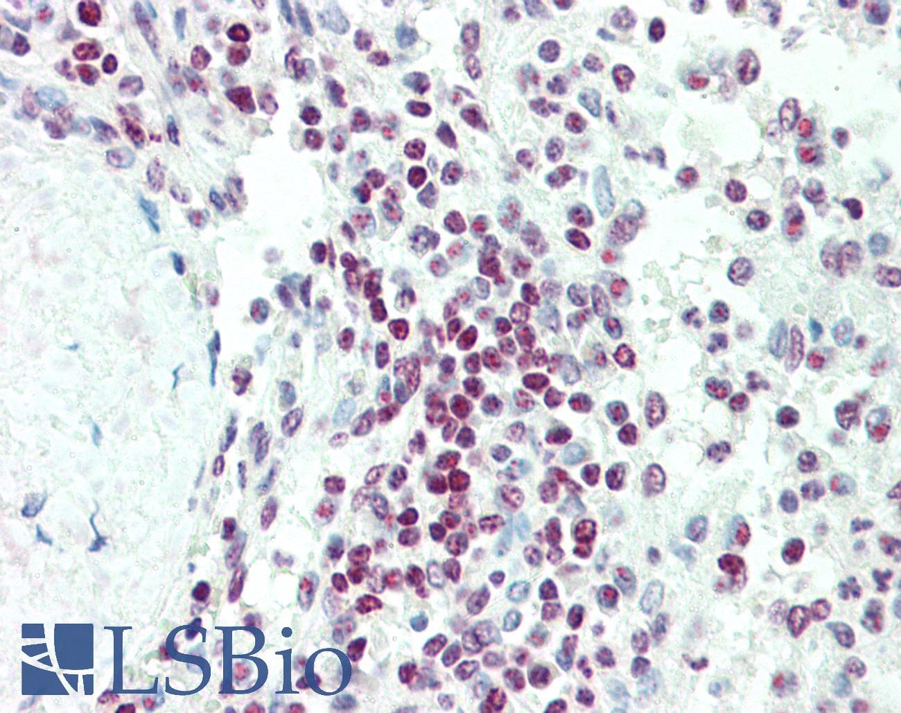 IHC-plus™ EDF1 / MBF1 Antibody (aa49-63)