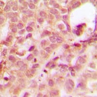 ABL1 / c-ABL Antibody (N-Terminus)