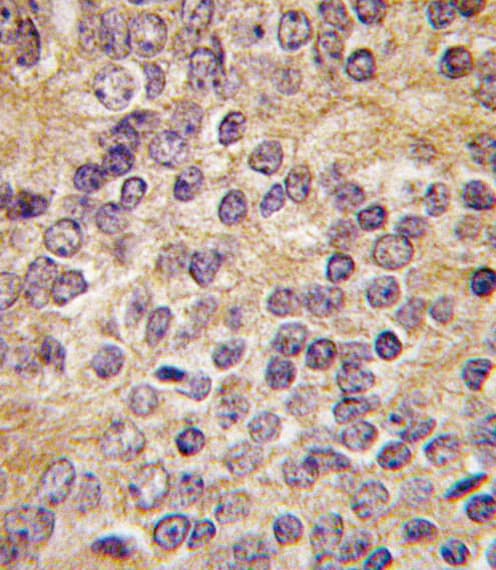Polyclonal Rabbit anti-Human PLAU / Urokinase / uPA Antibody (aa396-426, IHC, IF, WB)