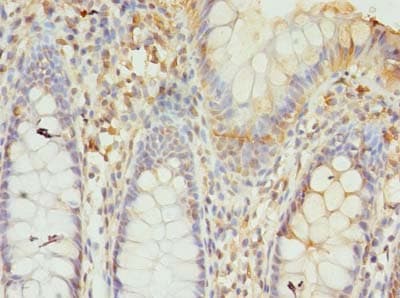 GTF3C6 Antibody