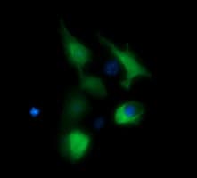 BBOX1 / BBOX Antibody (clone OTI1E11)