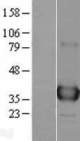 APEX1 / APE1 Protein (Over-Expression Lysate Myc-DDK (Flag))